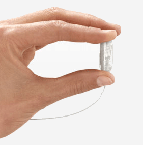 the obalon gastric balloon pill